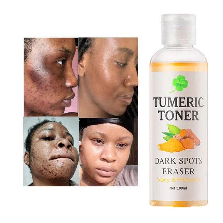 Tumeric Toner 12 Pcs