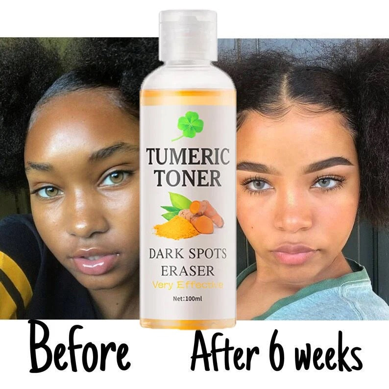 Tumeric Toner 12 Pcs