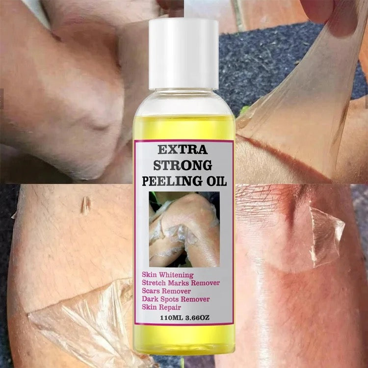 Extra Strong Peeling Oil 12 Pcs