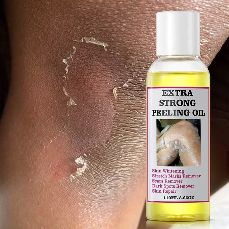 Extra Strong Peeling Oil 12 Pcs