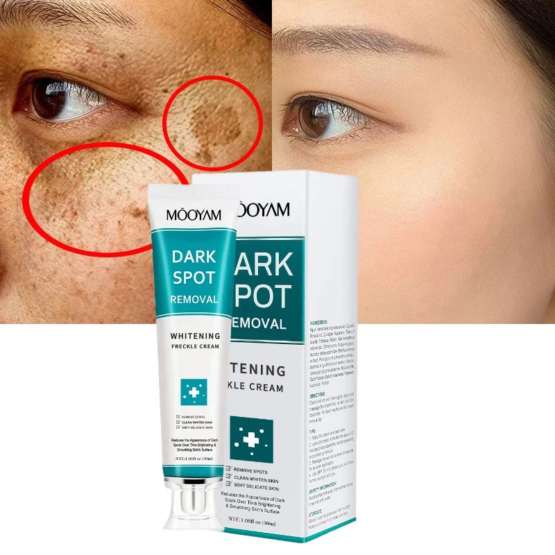 Mooyam Dark Spot 12 Pcs