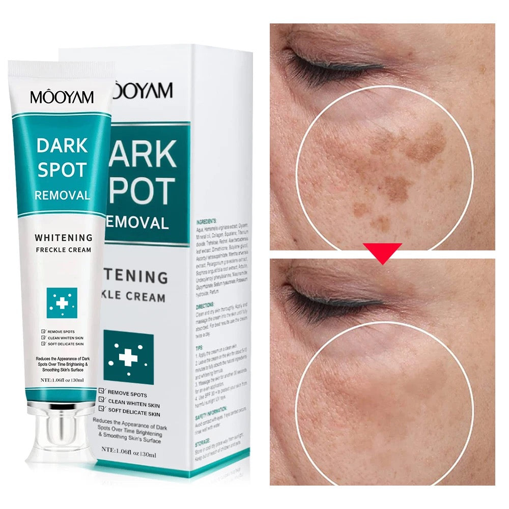 Mooyam Dark Spot 12 Pcs