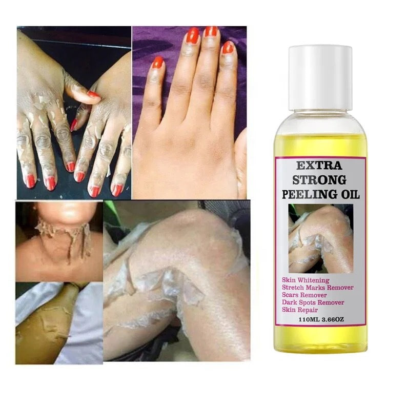 Extra Strong Peeling Oil 12 Pcs